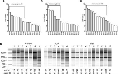 Gene Expression Analysis of the Pre-Diabetic Pancreas to Identify Pathogenic Mechanisms and Biomarkers of Type 1 Diabetes